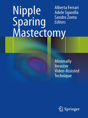 cover image of Nipple Sparing Mastectomy